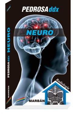 Pedrosa ddx Manual Neuro