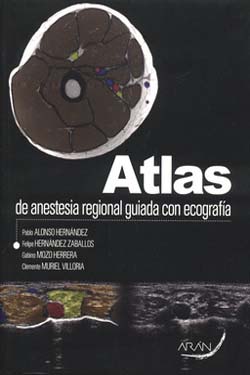 Atlas de Anestesia Regional Guiada por Ecografía
