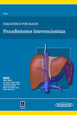 Diagnóstico por Imagen Procedimientos Intervencionistas