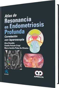 Atlas de Resonancia en Endometriosis Profunda