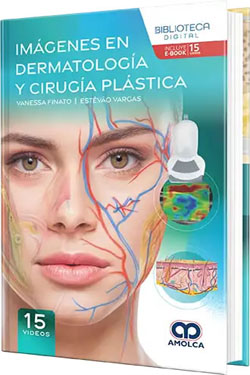 Imágenes en Dermatología y Cirugía Plástica