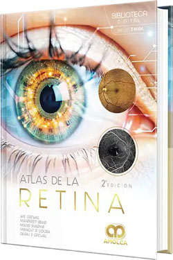 Atlas de la Retina
