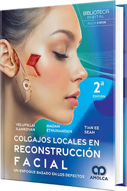 Colgajos Locales en Reconstrucción Facial