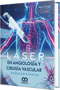 Láser en Angiología y Cirugía Vascular