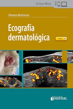 Ecografía Dermatológica