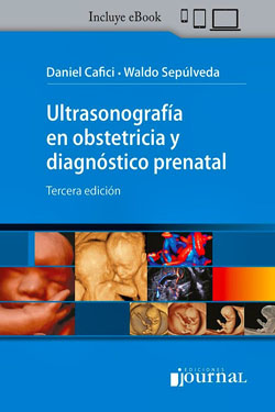 Ultrasonografía en Obstetricia y Diagnóstico Prenatal