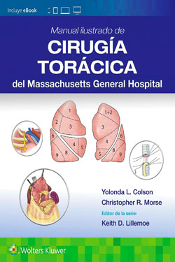 Manual Ilustrado de Cirugía Torácica del