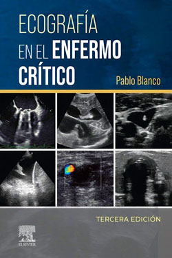 Ecografía en el Enfermo Crítico