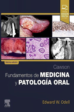 Cawson Fundamentos de Medicina y Patologi?a Oral