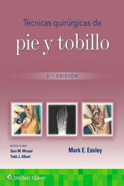 Tcnicas Quirrgicas de Pie y Tobillo
