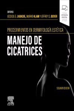 Manejo de Cicatrices
